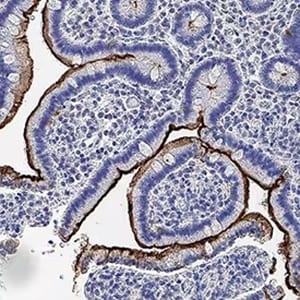 Blog IHC Kits MEP1b AF2895 IHC (chromogenic) image example