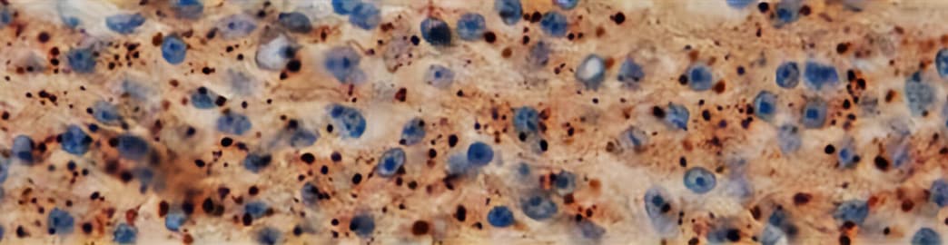 p62-detection-IHC-paraffin-banner.jpg