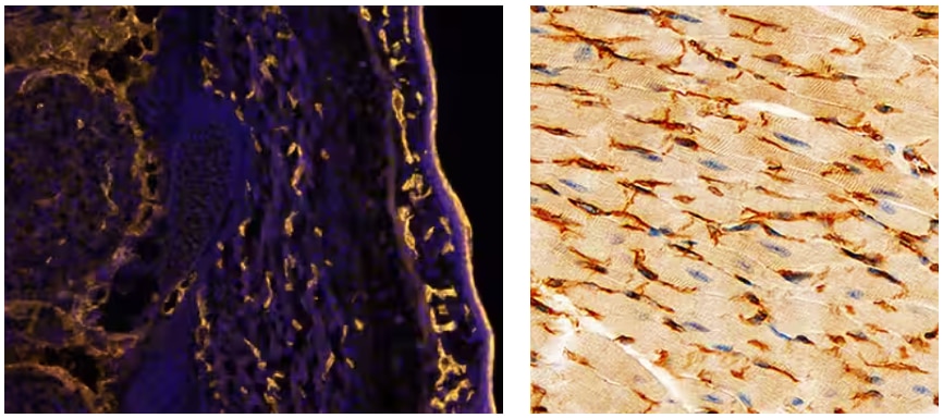Fluorescent IHC and IHC staining visualizing PRR expression in endothelial cells