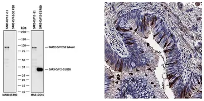 WB and IHC detection of SARS-CoV-2 Spike S1 and Spike S1 RBD.