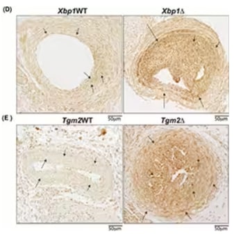 IHC analysis of IRE1 alpha expression in various carotid artery tissue sections.