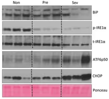 WB analysis of hepatic ER stress markers during cachexia progression in the liver of non, pre, and severely cachetic mice.