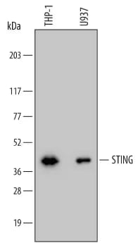 STING Antibody (723505) [MAB7169] Western blot analysis of STING protein in lysates from THP‑1 human acute monocytic leukemia an