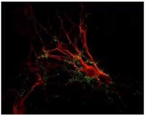 Synapsin I Antibody [NB300-104] ICC/IF analysis showing punctate distribution of Synapsin 1 protein (green) and MAP protein (red) in cultured rat caudate neurons.