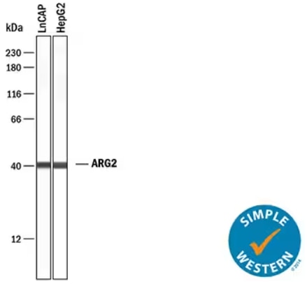 Simple Western analysis showing ARG2 expression in LnCAP and HepG2 prostate cancer cell lines. 