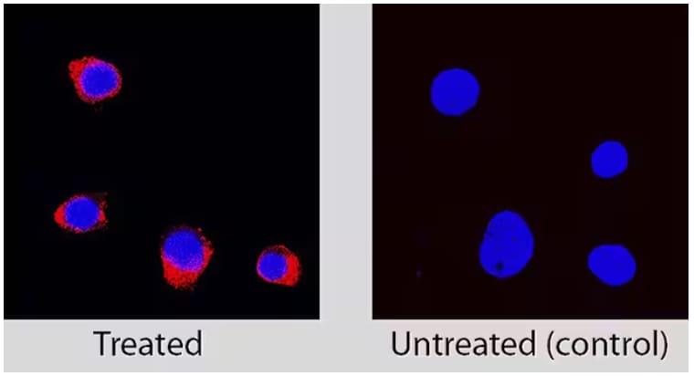 Immunocytochemical detection of caspase-3 in immersion fixed Jurkat human acute T cell leukemia cell lines treated with Staurosp