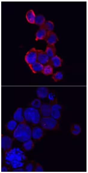 ICC image of NLRP3 expression in human THP-1 cells stimulated with or without PMA- and LPS-cells.