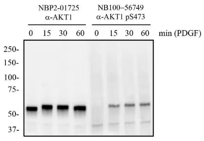 Visualization of AKT1 antibody western blot treated with and without PDGF.