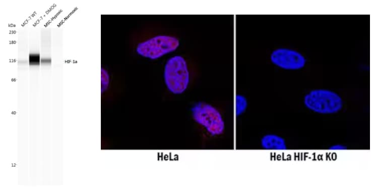 WB and ICC analysis of HIF-1a expression under various environmental conditions.