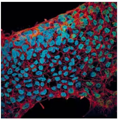 ICC staining of E-Cadherin in BG01V human embryonic stem cells.