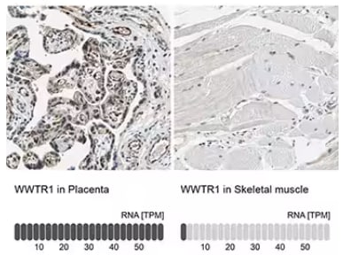 IHC staining of WWTR1 in placenta and skeletal muscle tissues.