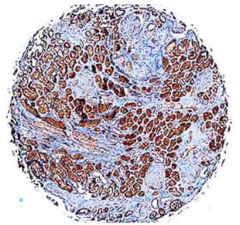 FABP1/L-FABP antibody