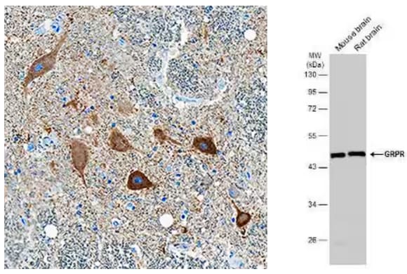 IHC staining of spinal cord motor neurons and WB of GRPR expression in mouse and rat brain.