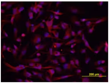 ICC staining of human glioblastoma cell line.