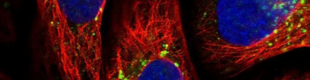 vps35-autophagy-pharmacologically-v2.jpg