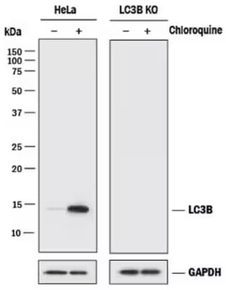Western blot of LC3B expression in HeLa cell treated and untreated with Chloroquine.