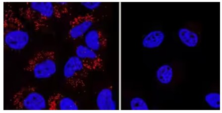 ICC analysis showing LC3B expression in Chloroquine-treated HeLa cells.