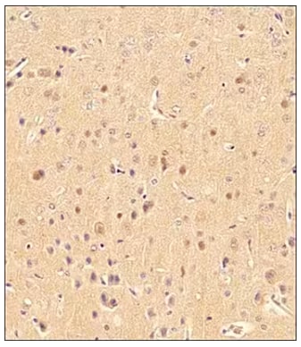 IHC analysis of LC3B expression in human brain tissue.