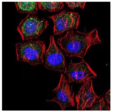 ICC analysis of LC3B expression in HeLa cells.