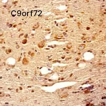 C9orf72 Antibody 