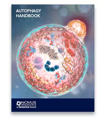 Autophagy Guide