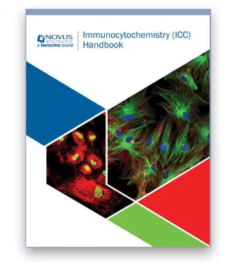 Thumbnail for Immunocytochemistry (ICC) Handbook