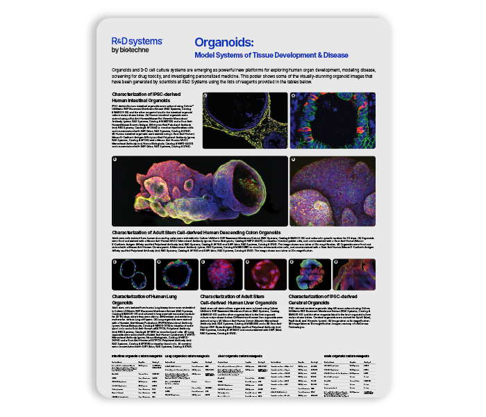 Organoids: Model Systems of Tissue Development and Disease Poster