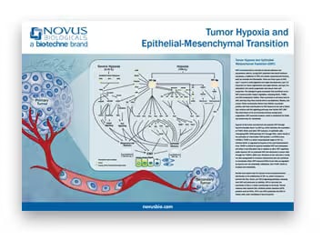 Tumor Hypoxia and EMT Poster