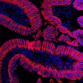 cadherin 17 IHC (fluorescence) image example