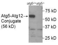 Western blot analysis of ATG5 Antibody