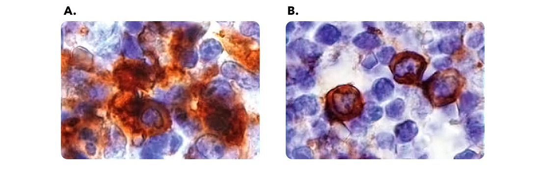 Figure 1: Blocking Non-specific Binding with Serum