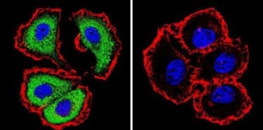 Figure 1: CC/IF analysis of NFATc1 in MCF7 cells 