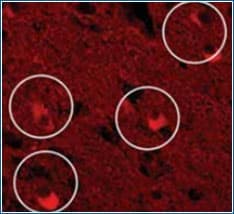 Figure 3: Lipofuscin-containing neurons 