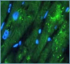 Figure 4: Fixative-induced autofluorescence in human cardiomyocytes.