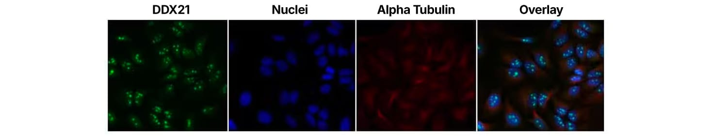 Figure 1: example of DDX21 detection in fixed HeLa cells 