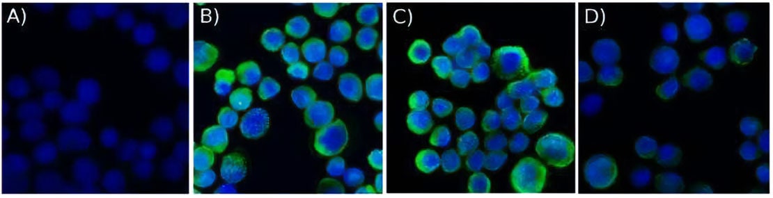 Figure 4 ICC/IF staining of cytokeratin in MCF7 cells using biotin conjugated pan Cytokeratin antibody