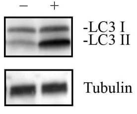 LC3 I and II expression in Neuro2a Chloroquine treated and untreated cell lysates.