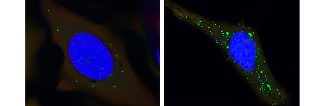 Fluorescent microscopy image of GFP-Puncta