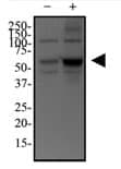 Western blot analysis of p62/SQSTM1 Antibody