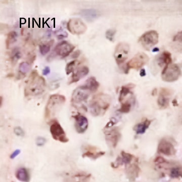 PINK1 Antibody 