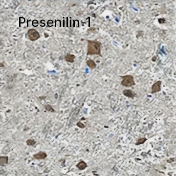 Presenilin-1 