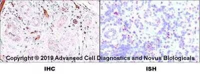 Tonsil tissue probed for use in dual RNAscope ISH-IHC application displaying both RNA and protein expression of CD31/PECAM1.