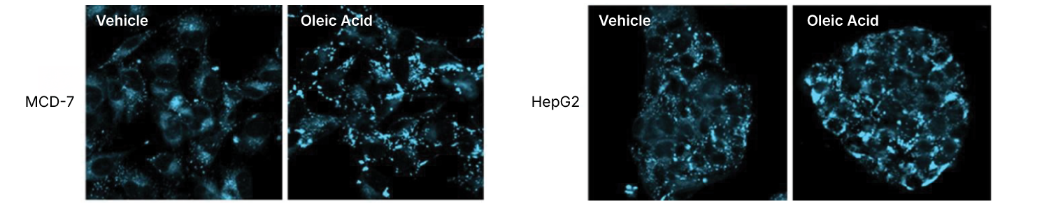 Composite fluorescence images of MCF-7 and HepG2 cells demonstrate rapid LipoLIVE™ Deep Red staining of lipid droplets following oleic acid treatment, highlighting lipid accumulation in live-cell models.