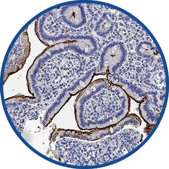 Figure 6: epitope tags in affinity purification