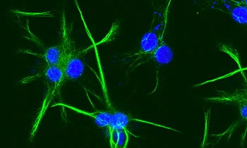 Figure 3: Cytokeratin 18 in fixed HeLa cells.