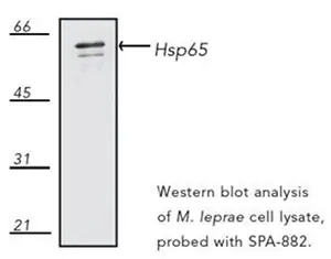 Western blot of 65-kDa heat shock protein (HSP65) expression in M. leprae cell lysate