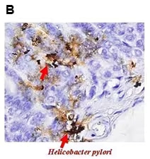 Immunohistochemistry analysis of Helicobacter pylori urase B in tissue from mice gastric pylori 