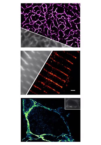 Cardiac tissue labeled with Janelia