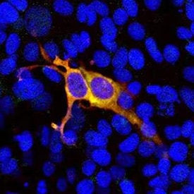 Expression of CRISPR-Cas9 in HEK293 Cells