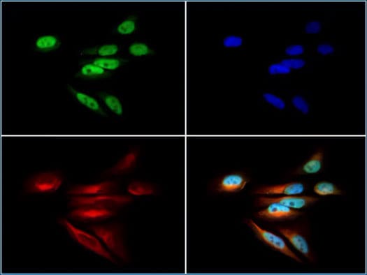 Immunocytochemistry image of DNMT1 antibody expression